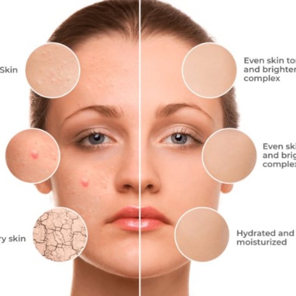 6 pcs jelly mask - Picture 6 of 6